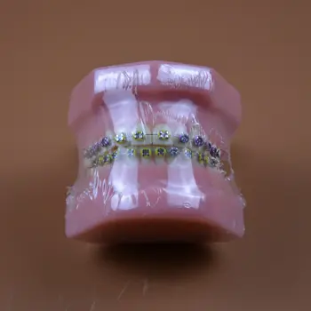 1 adet Ortodontik diş modelleri eğitim dişleri tam metal ayraç Diş Modelleri ile jaws model Diş ve Çene Modelleri | diş