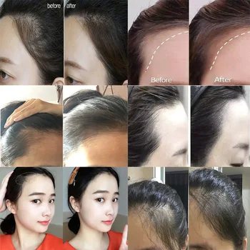 Büyülü Kabarık İnce Saç Tozu Pang Pang Saç Çizgisi Gölge Makyaj Saç Kapatıcı Kök 4g Anlık Gri Kapsama Örtbas